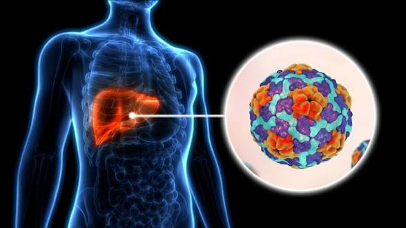 Silent Epidemic: 287 Million Living with Hepatitis as 1.3 Million Die Yearly — WHO Urges Urgent Action